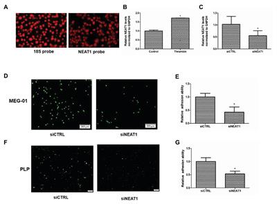 Downregulation of Long Non-coding RNA Nuclear Paraspeckle Assembly Transcript 1 Inhibits MEG-01 Differentiation and Platelet-Like Particles Activity